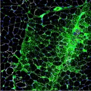 Bright Green Neuron image