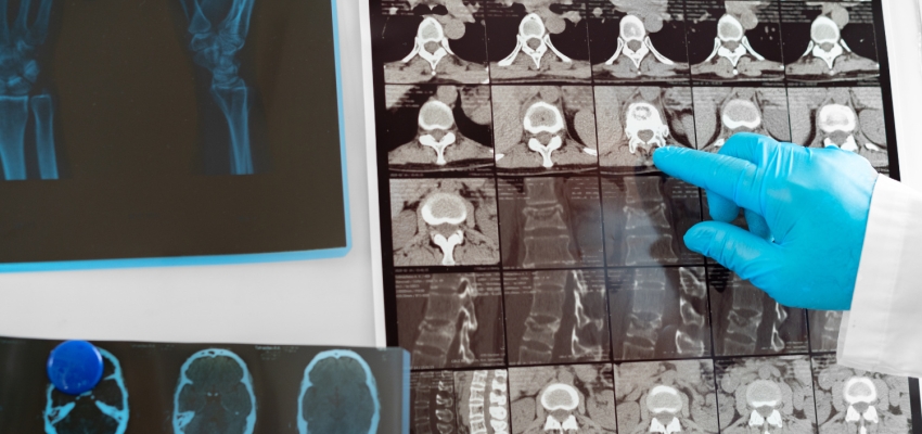 Examining medical scans posted on a board