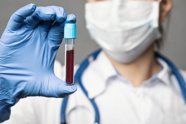 Doctor holding test tube of patient blood sample