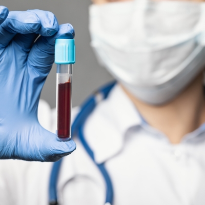 Doctor holding test tube of patient blood sample