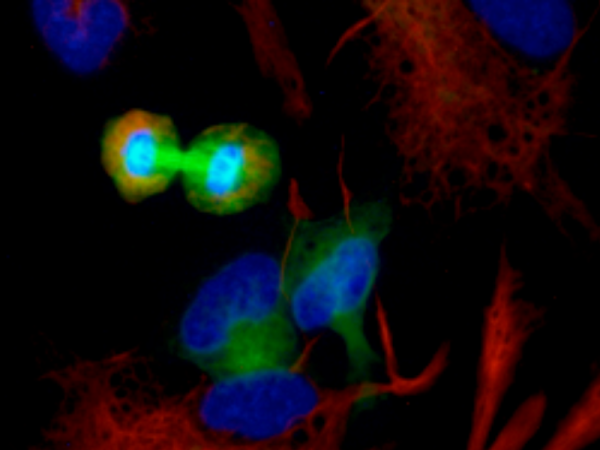 A dividing human neural progenitor cell with a visible mitotic bridge appears as two circles touching in the center. There are also Glial Fibrillary Acidic Protein (GFAP) cells shown as red lines/blotches. The βIII-tubulin protein is immunostained green; the nuclei is counterstained blue.