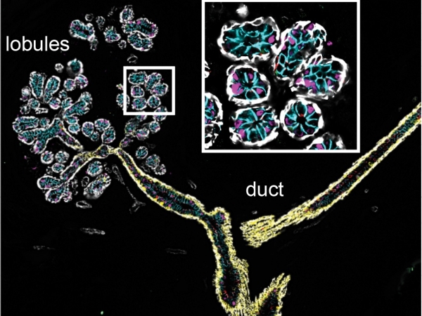 imaging shows different types of epithelial cells in the ducts and lobule structures of the human breast