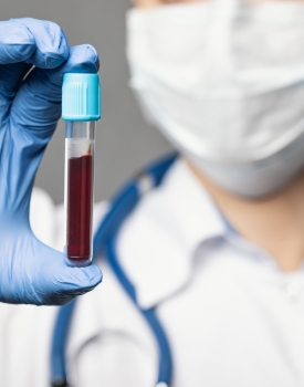 Doctor holding test tube of patient blood sample