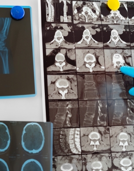 Examining medical scans posted on a board
