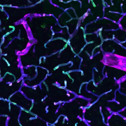 black background with purple and blue-green neurons