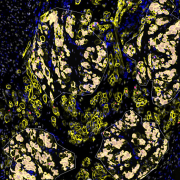 Lab-grown skeletal muscle cells