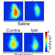 Results from control saline-treated test subjects and results of those treated with ketamine