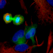 A dividing human neural progenitor cell with a visible mitotic bridge appears as two circles touching in the center. There are also Glial Fibrillary Acidic Protein (GFAP) cells shown as red lines/blotches. The βIII-tubulin protein is immunostained green; the nuclei is counterstained blue.