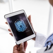 Doctor looks at a brain scan on a digital device