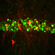 brain neurons abstract image red and green