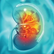 Kidney-Pancreas-Nephrology