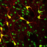 striatal cholinergic interneurons