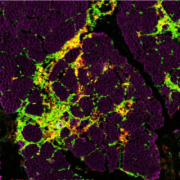 neuromuscular neurons green gold color