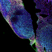 Confocal microscopy image of a human tonsil slice. B cells, the cells infected by EBV, are in centralized regions.
