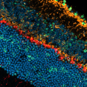 This image of a mouse retina shows the inner nuclear layer, ganglion cell layer and cone arrestin (thin red line in the middle). There are green dots scattered throughout a band of blue dots, indicating dying cells, and green dots along the top edge.