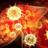 Liver damage such as Fatty liver, Fibrosis, Cirrhosis, and Liver cancer. 3d illustration stock photo