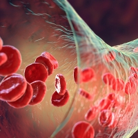 Blood clot made of red blood cells, platelets and fibrin protein strands. Thrombus, 3D illustration