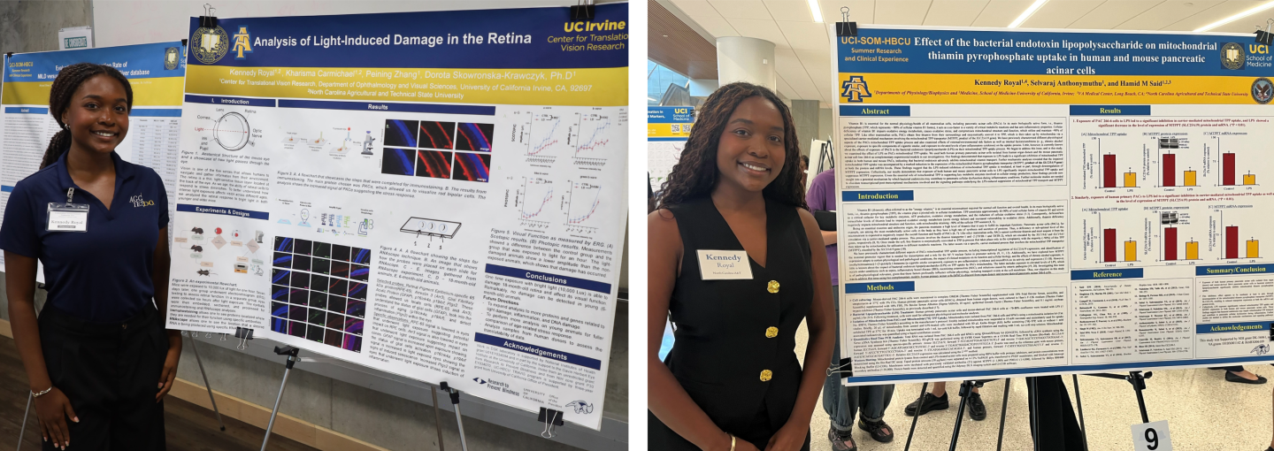 Two photos of Kennedy standing next to a large poster. The left poster is titled, “Analysis of Light-Induced Damage in the Retina.” The right poster is titled, “Effect of the bacterial endotoxin lipopolysaccharide on mitochondrial thiamin pyrophosphate uptake in human and mouse pancreatic acinar cells.” 