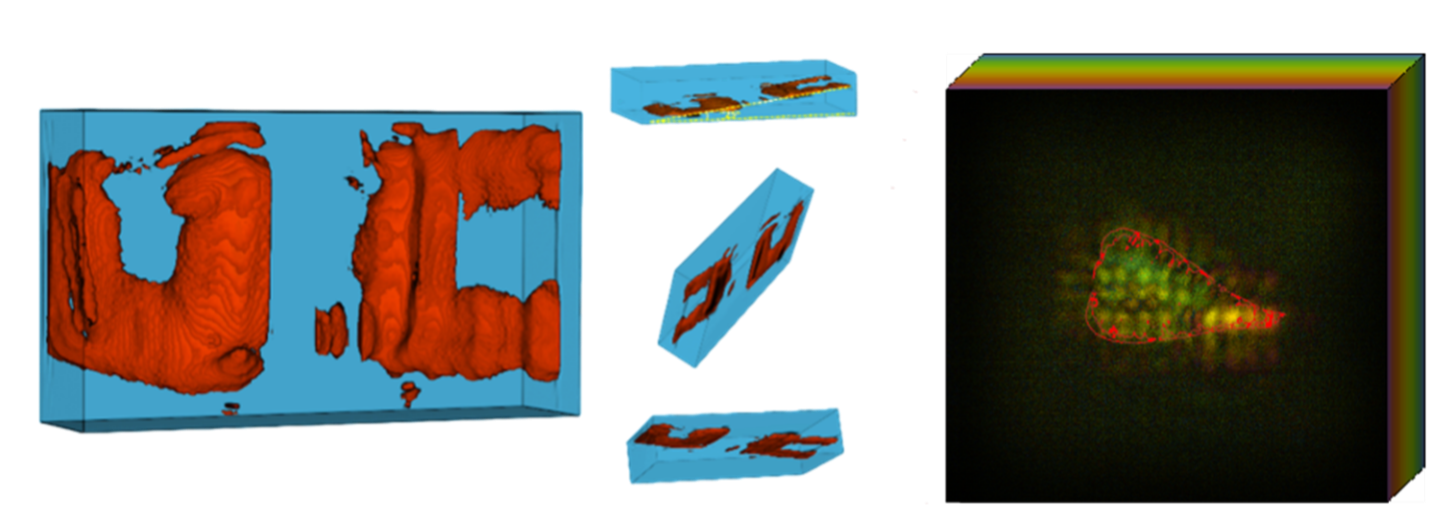 3D Imaging with XACT