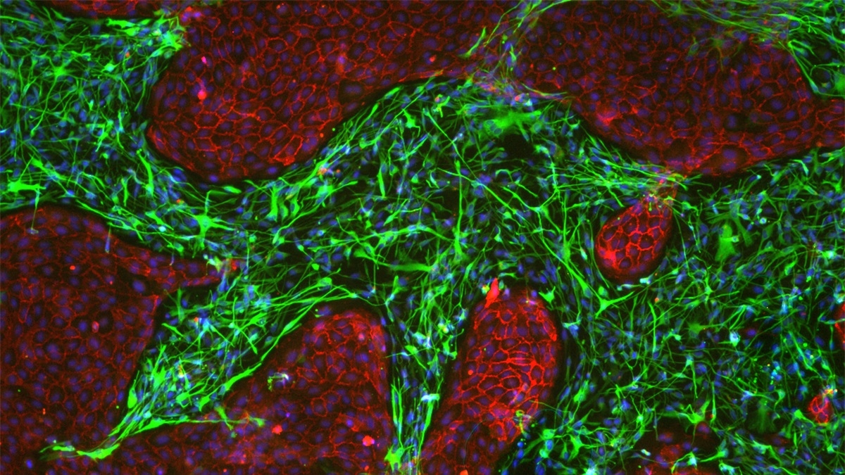 A group of stem cells, which appear as green lines, and blood vessel cells, which appear as blocks of red around the stem cells.