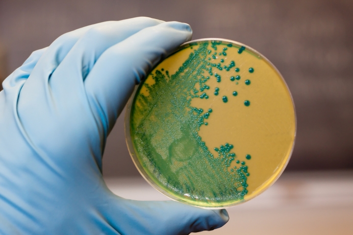 bacteria growing in dish