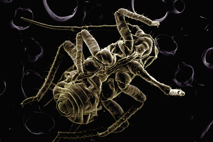 High vacuum SEM image of plant lice
