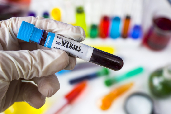 test tube labeled virus